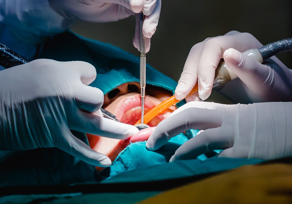 口腔外科のイメージ