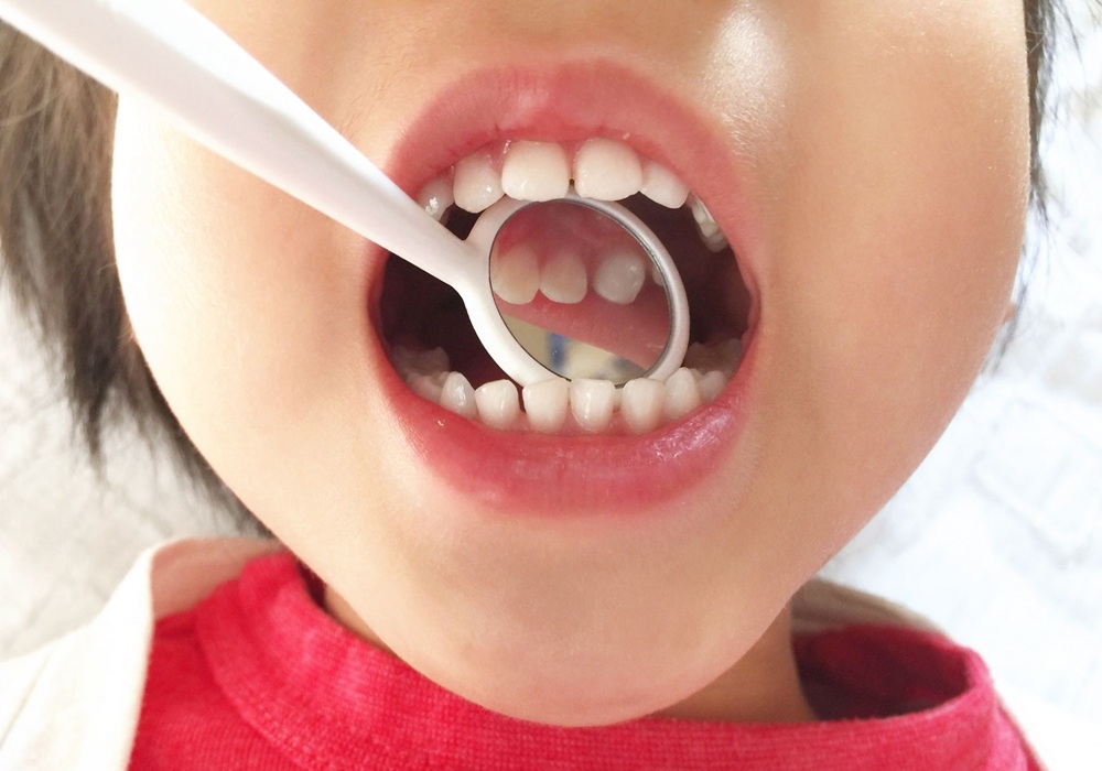 小児歯科のイメージ